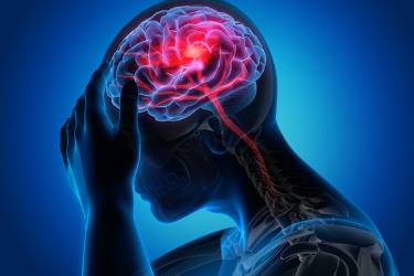 UTHealth Houston researchers are investigating how a special MRI protocol can help understand which patients might be at risk for hematoma expansion after intracerebral hemorrhage. (Photo by Getty Images)