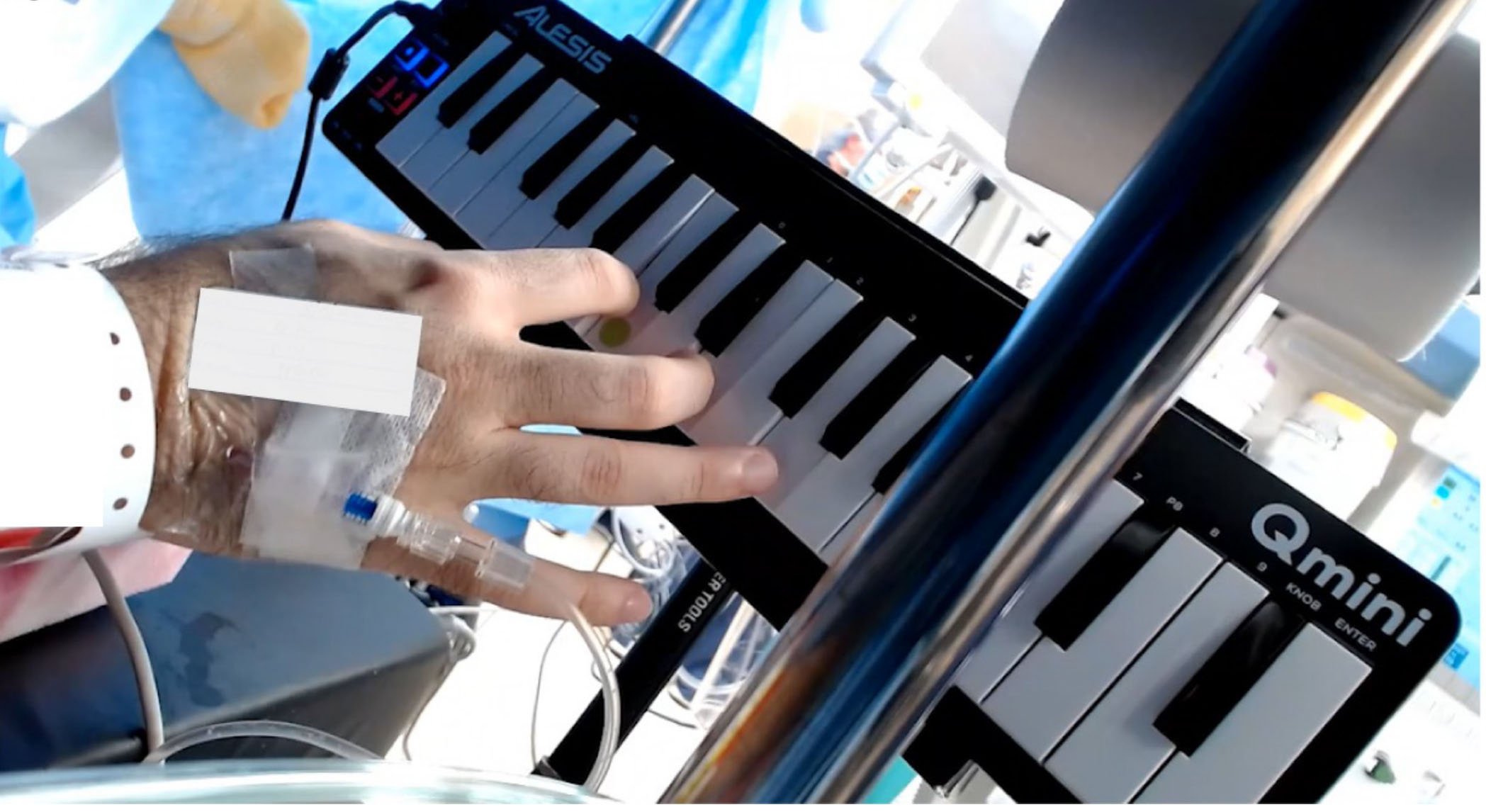 UTHealth Houston researchers observed as a brain tumor patient, who is also a musician, underwent an awake craniotomy while playing a mini-keyboard piano. (Photo provided by Elliot Murphy, PhD)
