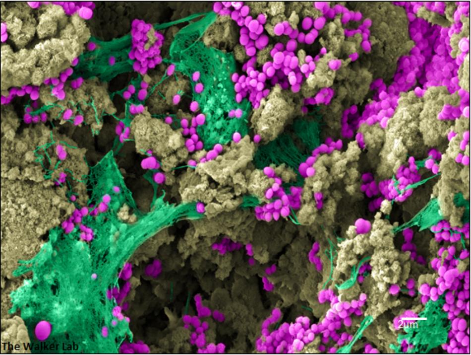cover montage of bacteria