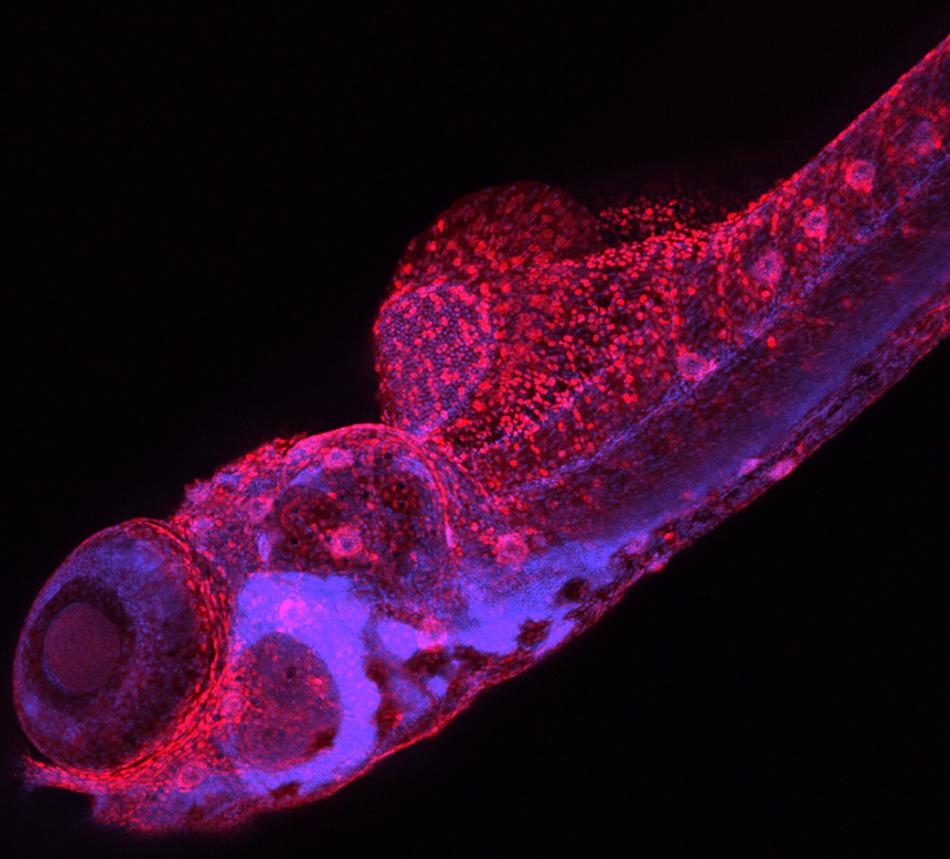 macrophages